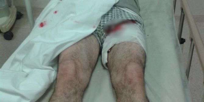 Ayının Saldırısına Uğrayan İnşaat Ustası Yaralandı