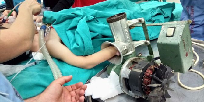Elini Kaptırdığı Kıyma Makinesiyle Hastaneye Kaldırıldı