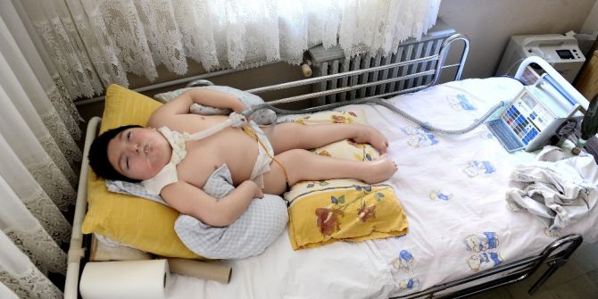 Acılı Anne, Yatağa Mahkum 7 Yaşındaki Mert Ali İçin Cumhurbaşkanı’na Çağrı Yaptı