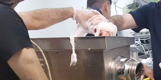 Elini Kaptırdığı Kıyma Makinesiyle Hastaneye Kaldırıldı