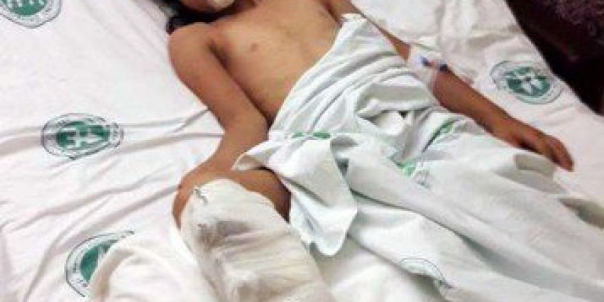 Kandıra’da İki Ayrı Kazada 2 Çocuk Yaralandı