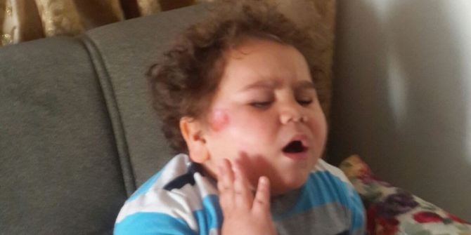 Çitos Efe’ye Nazar Değdi