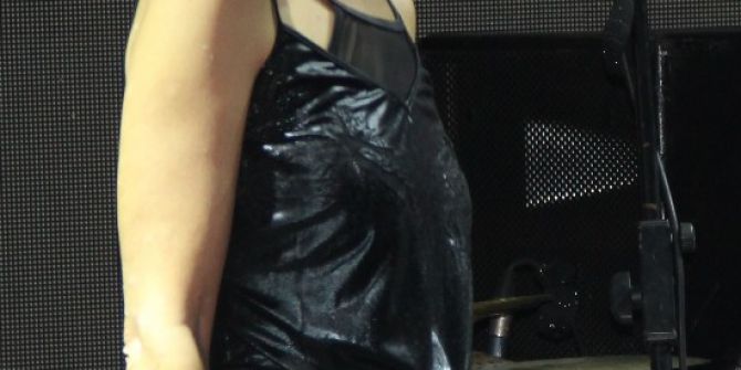 Yıldız Tilbe’nin Kolundaki Lekeler Azalmaya Başladı