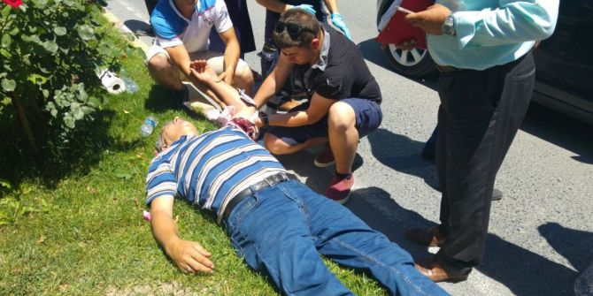 Yolun Karşısına Geçmek İsterken Otomobil Çarptı