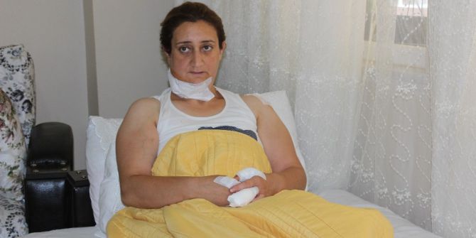 Boşandığı Eşi Tarafından Boğazı Kesilen Kadın Ölümden Döndü