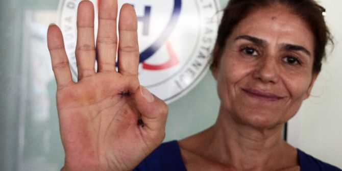 Ev Hanımlarına Tetik Parmak Uyarısı