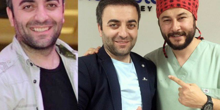 Sönmez: “Saç Ekiminde 2. Seans Şart Değil”