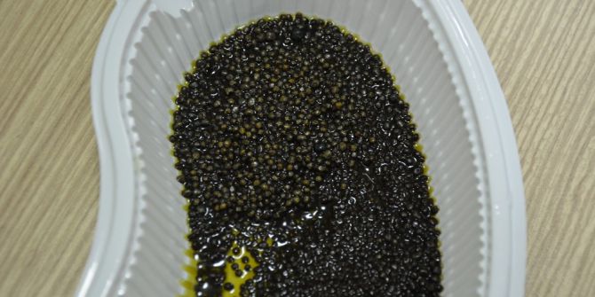 Safra Kesesi Değil Taş Ocağı