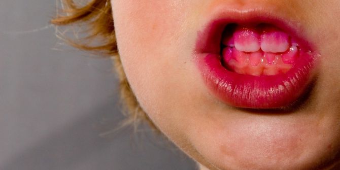 Balıbey ‘Diş Lekelerinde Çözüm Kişiye Özel Olmalı’