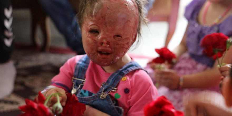 Suriyeli Çocukların Dramı