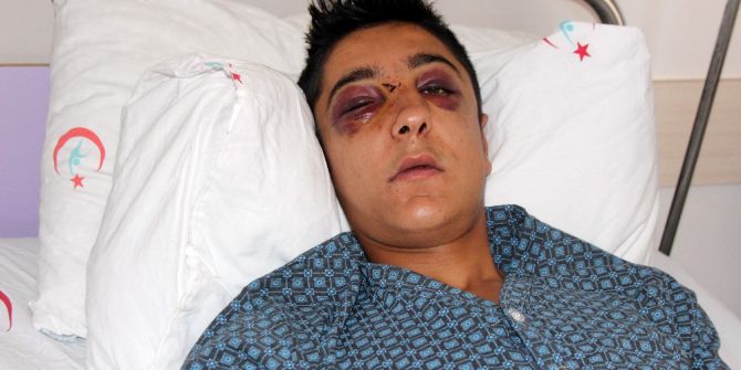 Hesap Yüzünden Dövülen Gencin Dişleri, Burnu Ve Elmacık Kemiği Kırıldı