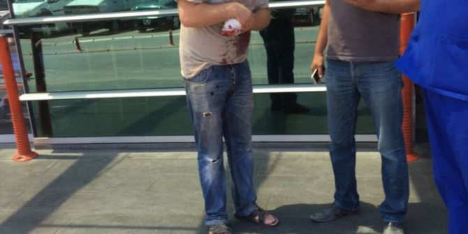 İş Kazasında Parmağını Kaybetti