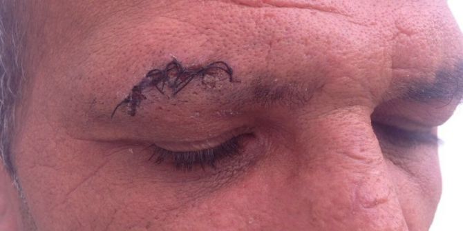 Engelli Merkezinde Kan Donduran İddialar