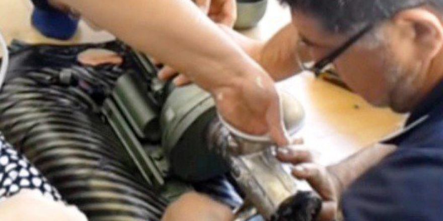 Elini Kaptırdığı Kıyma Makinesiyle Hastaneye Kaldırıldı