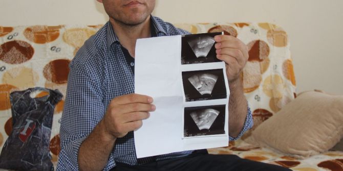 Önce Babasını, Ardından Babasından Nakil Aldığı Böbreğini Kaybetti