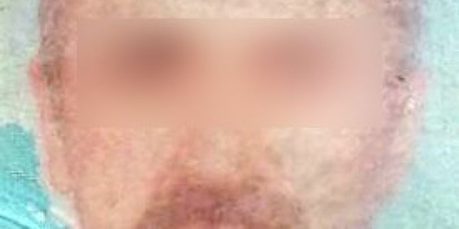 11 Yaşındaki Kıza Cinsel İstismarda Bulunan Şahıs Yakalanacağını Anlayınca İntihara Kalkıştı