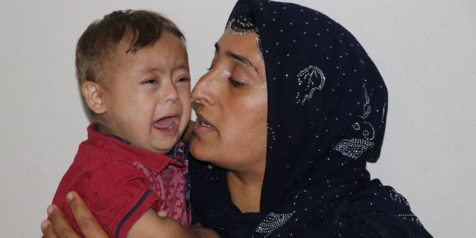 Tedavi Bekleyen Down Sendromlu Çocuk İdrarını Acılar İçinde Yapıyor