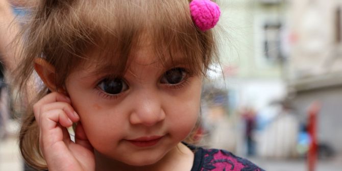 Sol gözünü tamamen kaybetme riski olan  Simay bebek yardım eli bekliyor