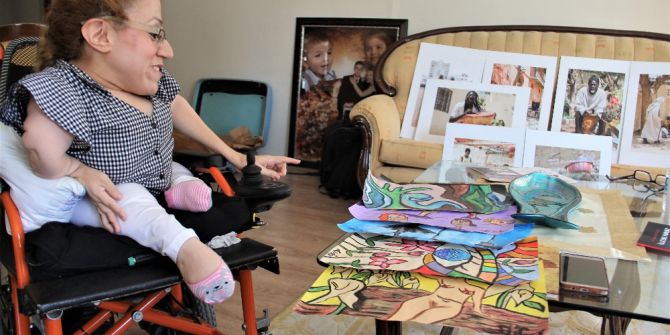 Cam kemik hastası kadının on parmağında on marifet