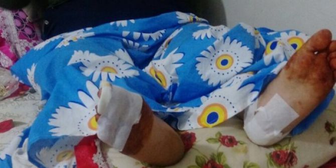 10 çocuk annesi yıkılan merdivenin altında kaldı