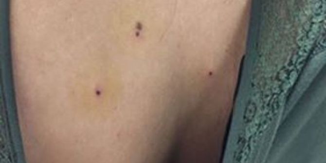 Kına eğlencesinde maganda dehşeti: 10 yaralı