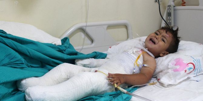 Tandıra düşen 2 yaşındaki çocuk feci şekilde yandı