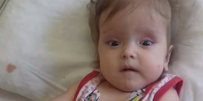 11 aylık Sümeyye’nin yaşı küçük derdi büyük
