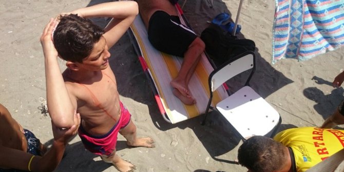 Denize atlayan gencin  başı yarıldı