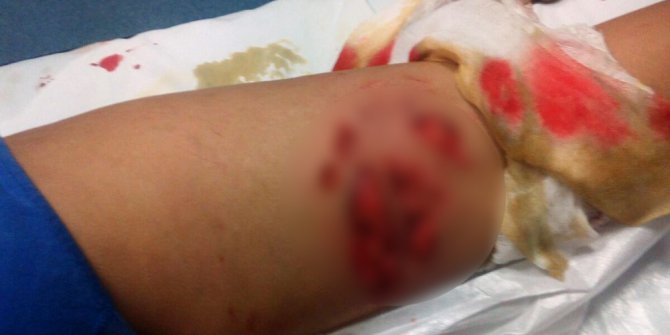 Eskişehir’de köpek dehşeti