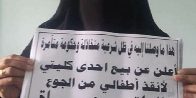 Yemenli kadın çocukları için böbreğini satışa çıkarttı