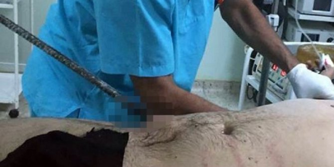 Karnına saplanan bir metre demir çubukla hastaneye getirildi