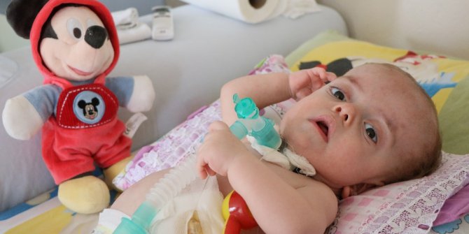 15 aylık Umut bebeğin yaşam savaşı