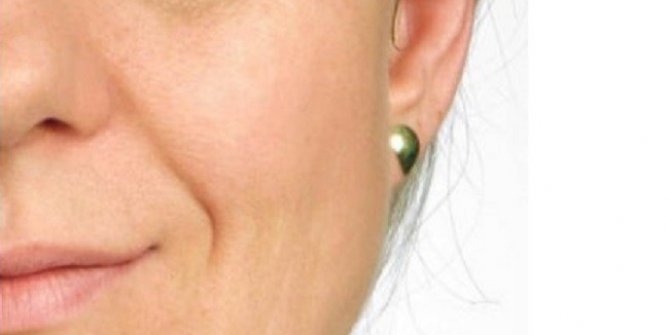 Sarkık göz kapağı yorgunluk sebebi