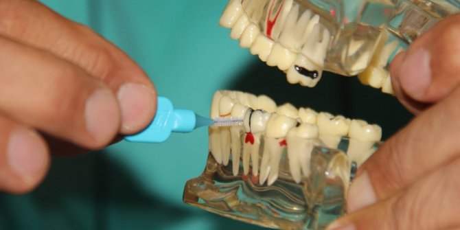 Et yedikten sonra bunlar mutlaka yapılmalı