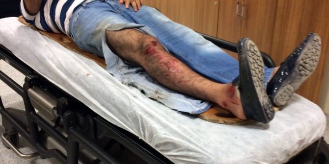 Polisin yakaladığı şahıs kazaya neden oldu: 1’i polis 2 yaralı