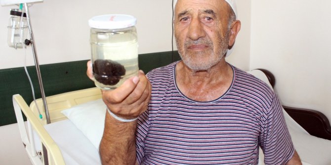 Mesanesinden 120 gram taş çıktı