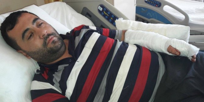 Lokantada yemek yerken maganda kurşunuyla yaralandı