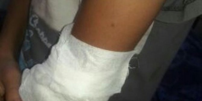 Oyun oynarken koluna tığ battı