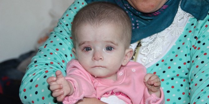 Kanser hastası 10 aylık Alime’nin bakışları yürek yakıyor