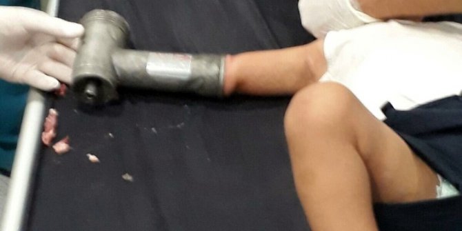 2 yaşındaki çocuk elini kıyma makinesine kaptırdı