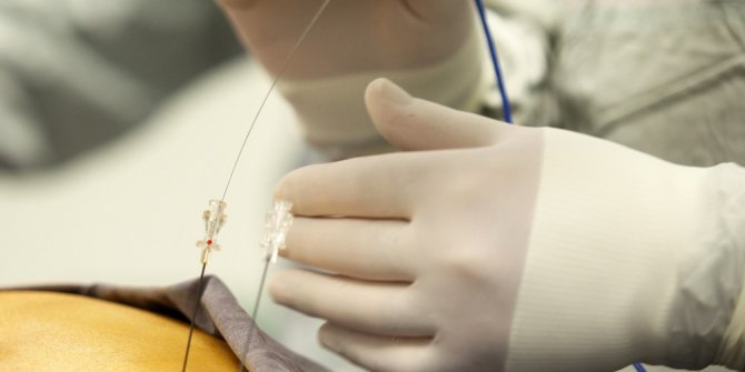 Bel fıtığı rahatsızlığında gereksiz ameliyatlar ağrıyı arttırıyor