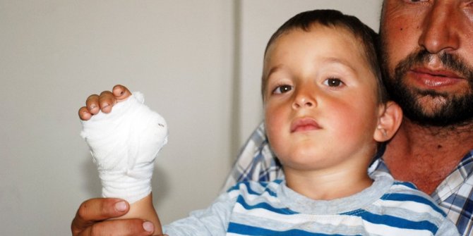 3 yaşındaki çocuğun nacakla kesilen parmağı yerine dikilemedi