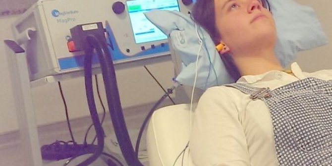 "Felçli hastalarda yeni tedavi yöntemi; TMS tedavisi“