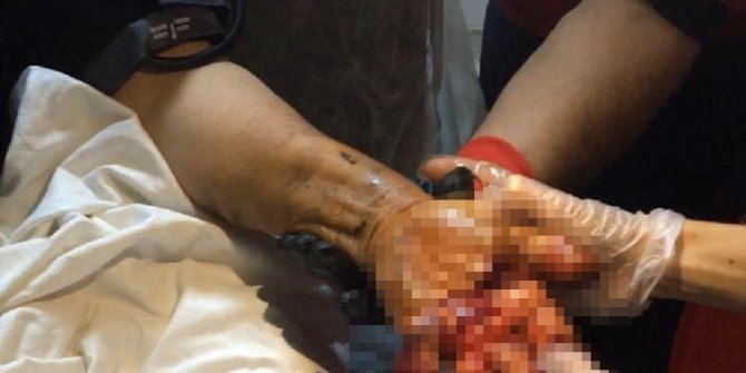 Eli kıyma makinesine sıkışan kadının yardımına itfaiye yetişti