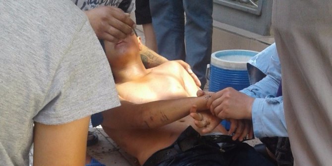 İş yerini temizlemek için tiner kullanan 2 kişi hastanelik oldu