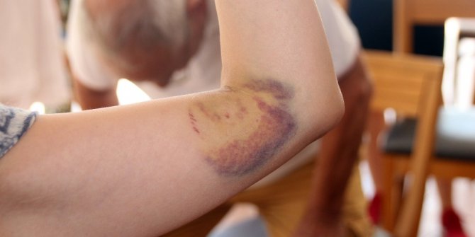 Caretta caretta bu sefer Japonlara saldırdı