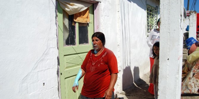 Yemek yaparken kendini yaktı