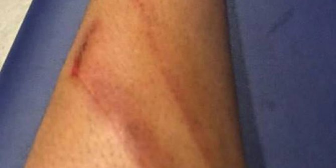 Aytaç Kara’dan maçın hakemine fotoğraflı tepki