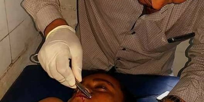 Husi militanları sivilleri hedef aldı: 3 ölü, 8 yaralı