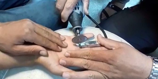 İtfaiyeden yüzük operasyonu